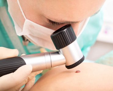 Detección más temprana del melanoma con inteligencia artificial