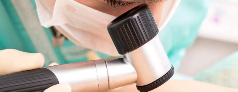 Detección más temprana del melanoma con inteligencia artificial