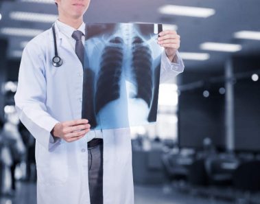 Stanford desarrolla CheXNet, un algoritmo de IA capaz de diagnosticar la neumonía mejor que los radiólogos